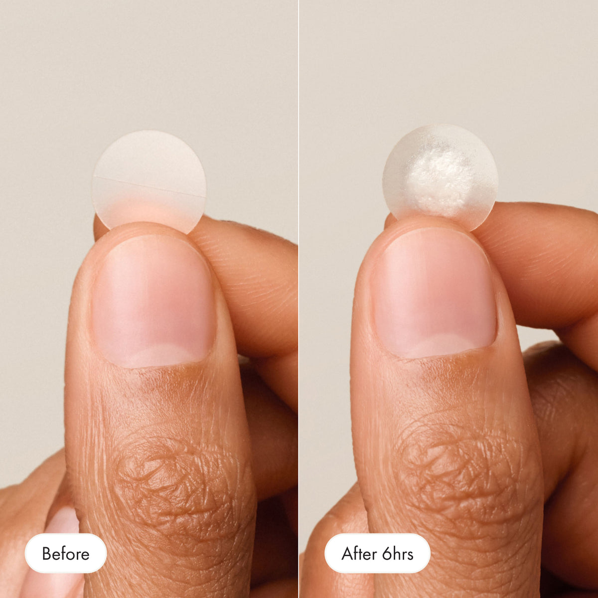 Mighty Patch™ Original - Product Image 6